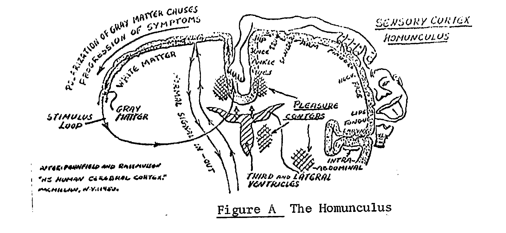 Fig A: L'homunculus